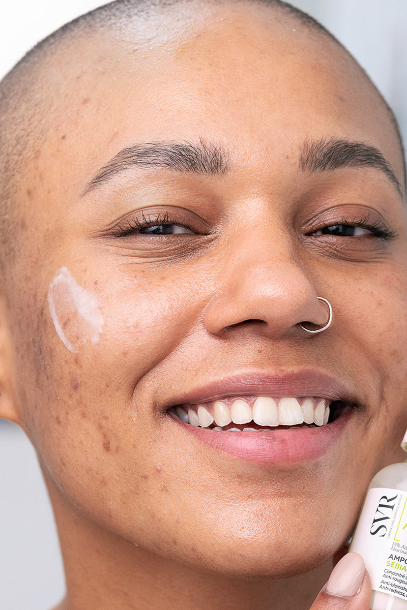 Donna sorridente tiene in mano il siero SVR Sebiaclear Ampoule Flash con contagocce su pelle con imperfezioni.